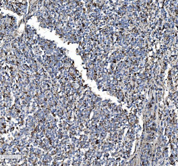 a02335 1 p4hb primary antibodies ihc testing 4