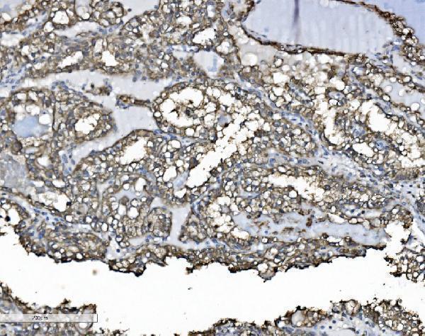 a02335 1 p4hb primary antibodies ihc testing 5