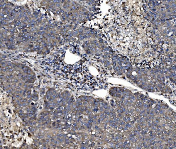 a02335 1 p4hb primary antibodies ihc testing 6