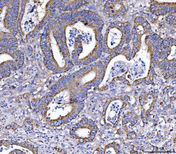  IHC analysis of EIF3A using anti-EIF3A antibody (A02339-3)
