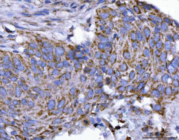  IHC analysis of EIF3A using anti-EIF3A antibody (A02339-3)
