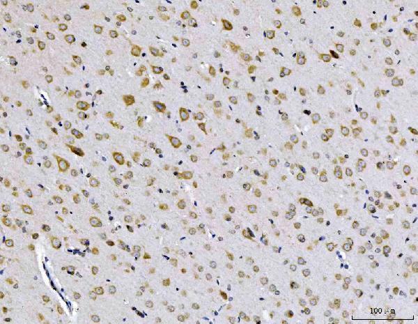 a02339 3 eif3a primary antibodies ihc testing 5