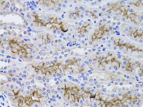 Immunohistochemistry of paraffin-embedded rat kidney using GGT1 antibody  at dilution of 1:100 