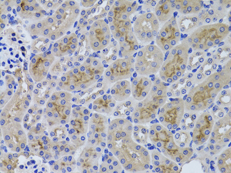 a02340 1 ggt1 primary antiboties ihc testing 4