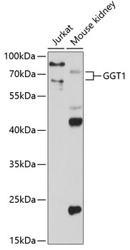 Western blot analysis of extracts of various cell lines, using GGT1 antibody  at 1:1000 dilution