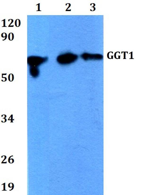 Western blot (WB) analysis of GGT1 polyclonal antibody at 1:500 dilution
Lane1:A549 whole cell lysate
Lane2:sp2/0 whole cell lysate 
Lane3:H9C2 whole cell lysate 