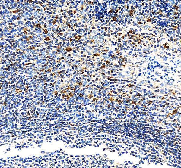 IHC analysis of ALOX5AP using anti-ALOX5AP antibody (A02341)