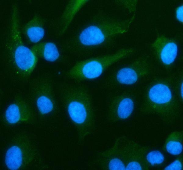  IF analysis of RPS19 using anti-RPS19 antibody (A02343-1)