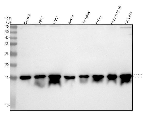  Western blot analysis of RPS19 using anti-RPS19 antibody (A02343-1)