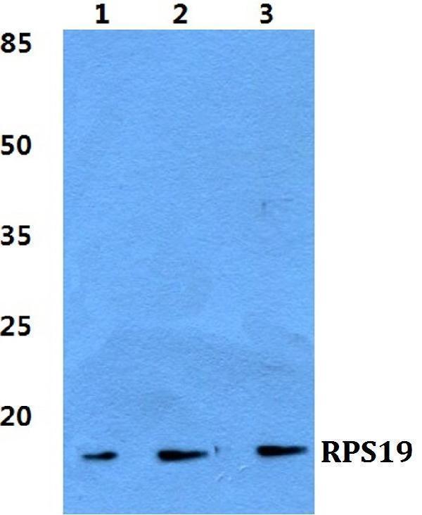 Western blot (WB) analysis of RPS19 polyclonal antibody at 1:500 dilution
Lane1:HEK293T cell lysate
Lane2:Raw264