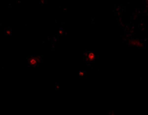 Immunofluorescence of STIM2 in Human Spleen cells with STIM2 antibody at 20 μg/mL