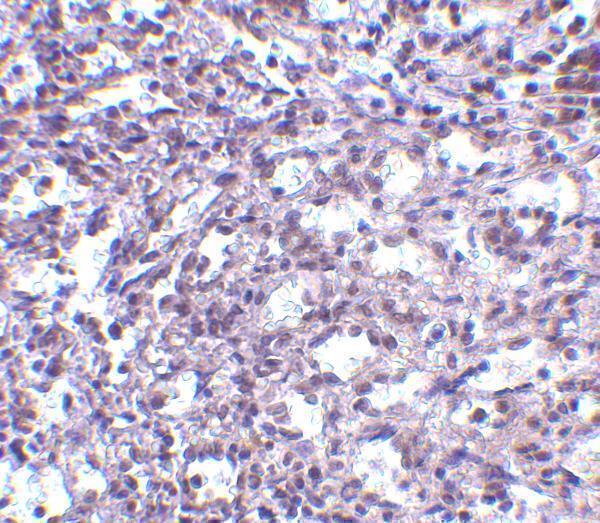 Immunohistochemistry of STIM2 in human spleen tissue with STIM2 antibody at 2