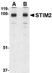 Western blot analysis of STIM2 in A-20 cell lysate with STIM2 antibody at (A) 0