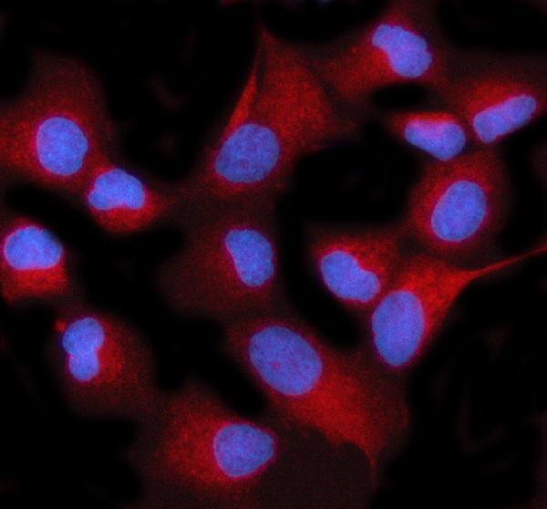  IF analysis of STIM2 using anti-STIM2 antibody (A02345-4)