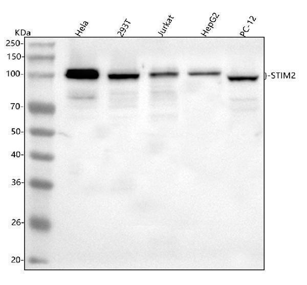  Western blot analysis of STIM2 using anti-STIM2 antibody (A02345-4)