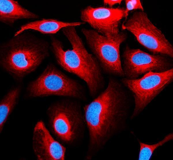 a02346 1 flnc primary antibodies if testing 1