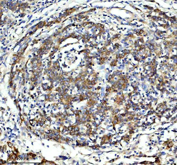 a02346 1 flnc primary antibodies ihc testing 1