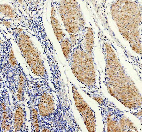 a02346 1 flnc primary antibodies ihc testing 2