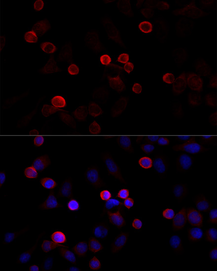 Immunofluorescence analysis of HeLa cells using FLNC antibody  at dilution of 1:100 