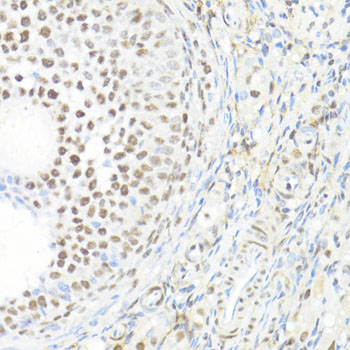 Immunoprecipitation analysis of 300ug extracts of K-562 cells using 3ug BACH1 antibody 