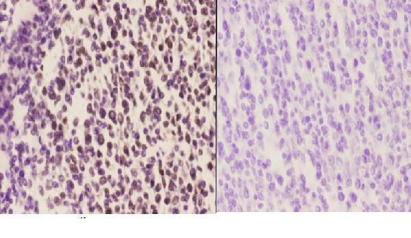 a02347 bach1 primary antiboties ihc testing 2