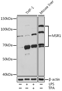 a02349 msr1 primary antiboties wb testing 1
