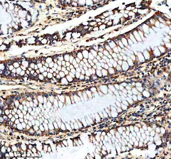 IHC analysis of Hepsin/HPN using anti-Hepsin/HPN antibody (A02350-1)