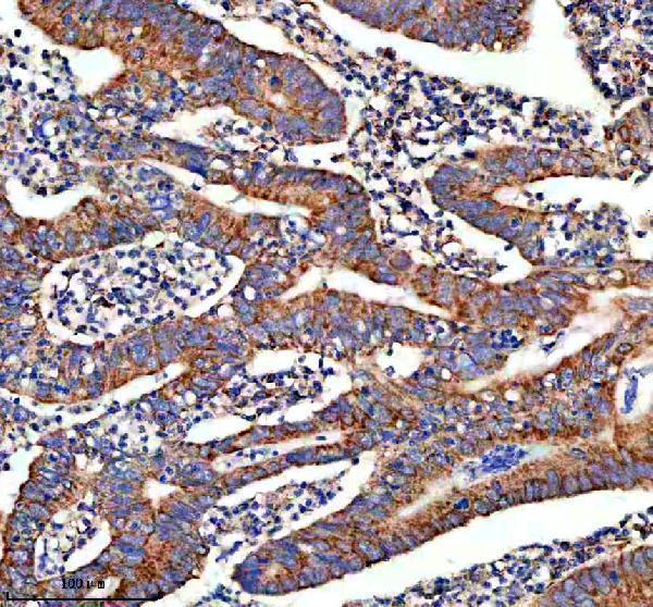 IHC analysis of Hepsin/HPN using anti-Hepsin/HPN antibody (A02350-1)