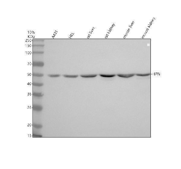 Western blot analysis of Hepsin/HPN using anti-Hepsin/HPN antibody (A02350-1)