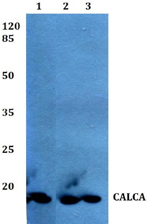 Western blot (WB) analysis of Calcitonin polyclonal antibody at 1:500 dilution
Lane1:HEK293T whole cell lysate
Lane2:Mouse heart tissue lysate
Lane3:Rat heart tissue lysate