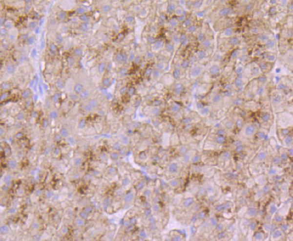 Immunohistochemical analysis of paraffin-embedded human liver tissue using anti-Transferrin Receptor 2 antibody