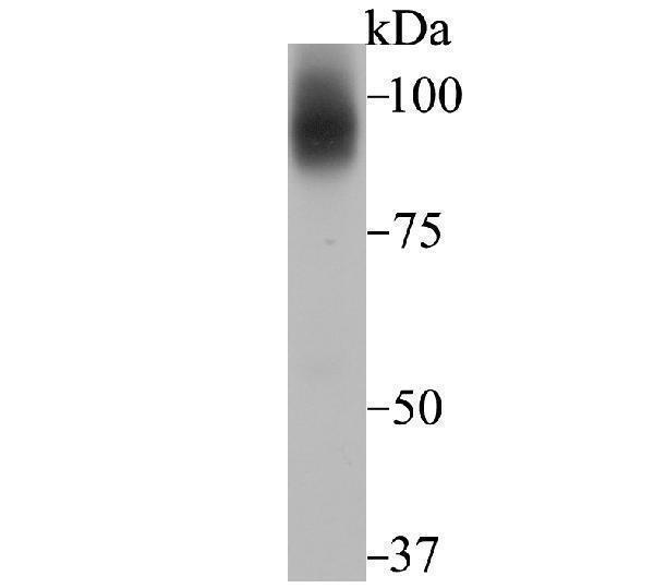 Western blot analysis of Transferrin Receptor 2 on HepG2 cell using anti-Transferrin Receptor 2 antibody at 1/1,000 dilution