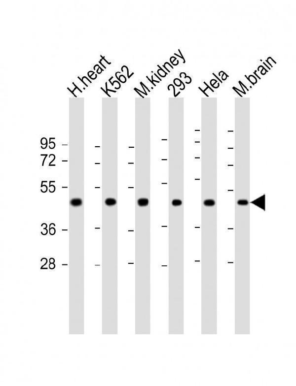 All lanes : Anti-hGDF11-R47 at 1:2000 dilutionLane 1: human heart lysateLane 2: K562 whole cell lysateLane 3: mouse kidney lysateLane 4: 293 whole cell lysateLane 5: Hela whole cell lysateLane 5: mouse brain lysateLysates/proteins at 20 µg per lane