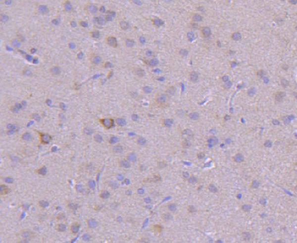 a02356 1 pik3c3 primary antiboties ihc testing 2