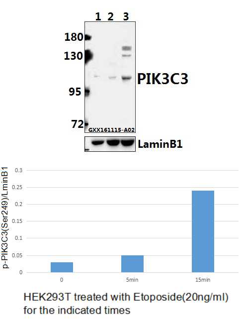 Western blot (WB) analysis of ULK1 (S757) polyclonal antibody at 1:500 dilution
Lane1:L02 whole cell lysate(40ug)
Lane2:Panc1 whole cell lysate(40ug)
Lane3:C6 whole cell lysate(40ug)
Lane4:AML-12 whole cell lysate(40ug)