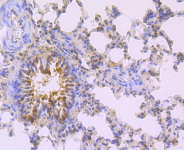 a02357 2 mad2l2 primary antiboties ihc testing 2