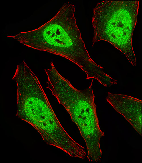 a02357 3 anti mad2l2 antibody c term if testing 1