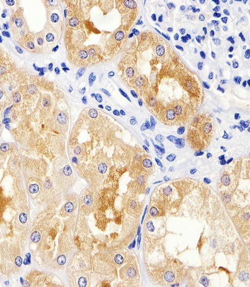 a02357 3 anti mad2l2 antibody c term ihc p testing 3