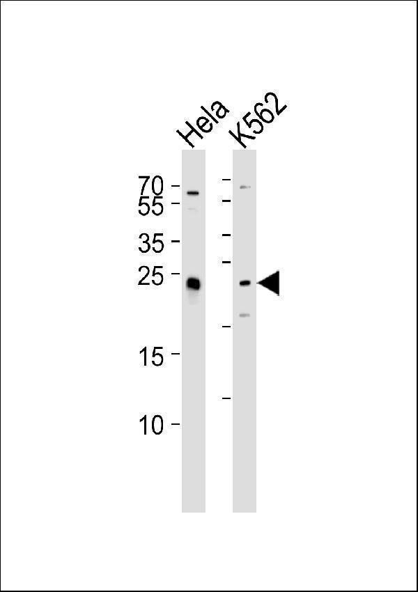 a02357 3 anti mad2l2 antibody c term wb testing 2