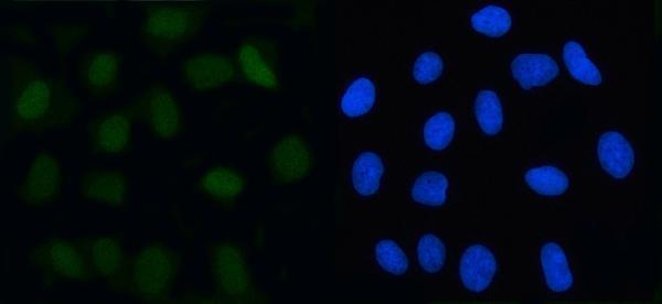a02357 4 mad2l2 primary antibodies if testing 3
