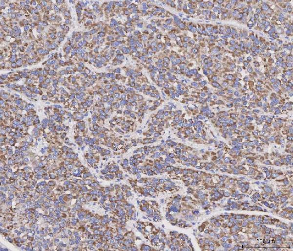 a02357 4 mad2l2 primary antibodies ihc testing 2