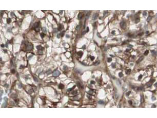a02357 mad2l2 primary antibodies ihc testing 1_1