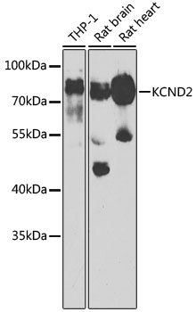 a02358 kcnd2 primary antiboties wb testing 1