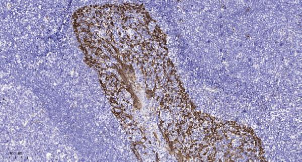 a02358s616 kcnd2 primary antibodies ihc testing 1