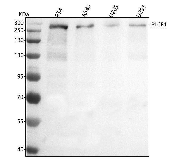  Western blot analysis of PLCE1 using anti-PLCE1 antibody (A02360-1)
