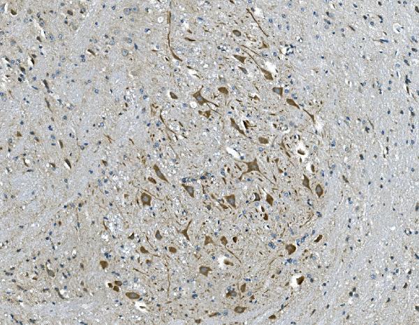  IHC analysis of GABA A Receptor gamma 2/GABRG2 using anti-GABA A Receptor gamma 2/GABRG2 antibody (A02361-1)