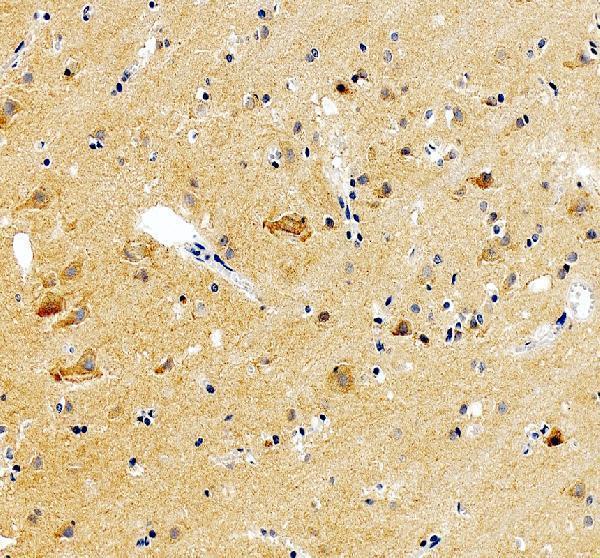 a02361 1 gabrg2 primary antibodies ihc testing 3