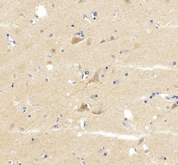 IHC analysis of GABRG2 using anti-GABRG2 antibody (A02361-1)