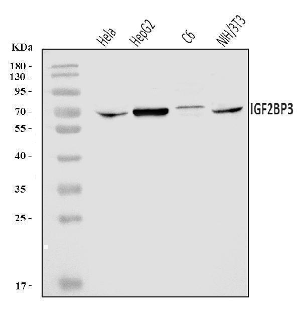  Western blot analysis of IMP3/IGF2BP3 using anti-IMP3/IGF2BP3 antibody (A02362-1)