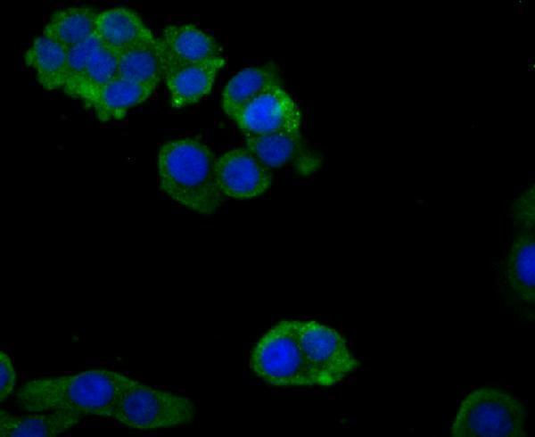a02365 zyx primary antiboties icc testing 2